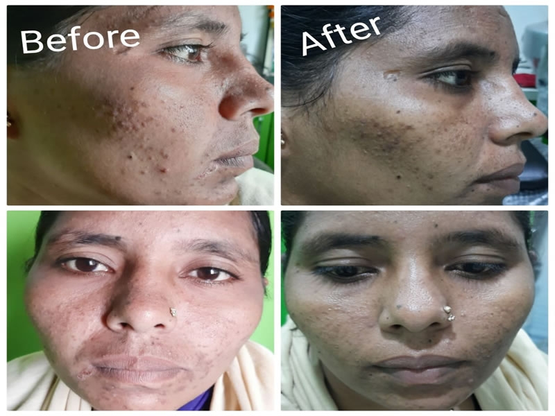 Before After Treatment Photos 